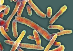 e.coli; ScienceImages.com